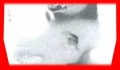 Thumbnail for version as of 04:51, 17 August 2007
